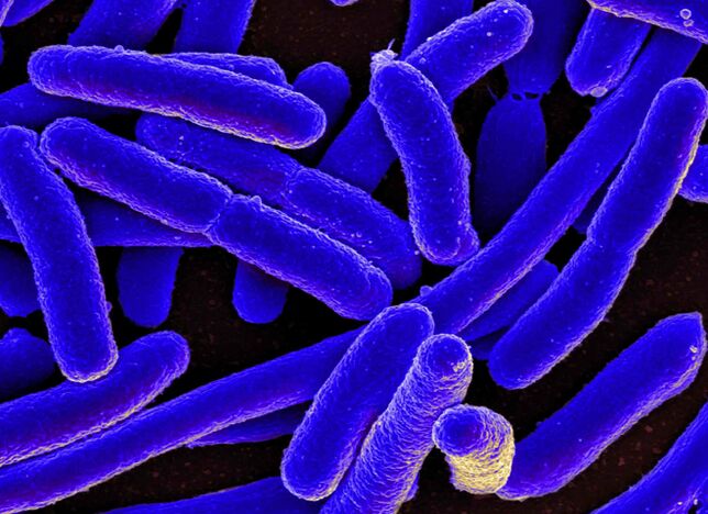 E. coli аксар вақт боиси рушди цистит дар занон мегардад